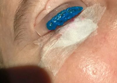 Blue setting lotion